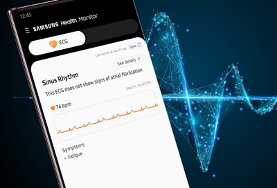 ecg samsung