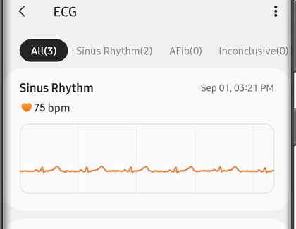 ECG history screen with All tab selected on a Galaxy phone